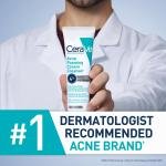 CeraVe Acne Foaming Cream Cleanser, 5 Fl Oz (Pack of 1), Packaging may Vary