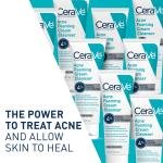 CeraVe Acne Foaming Cream Cleanser, 5 Fl Oz (Pack of 1), Packaging may Vary