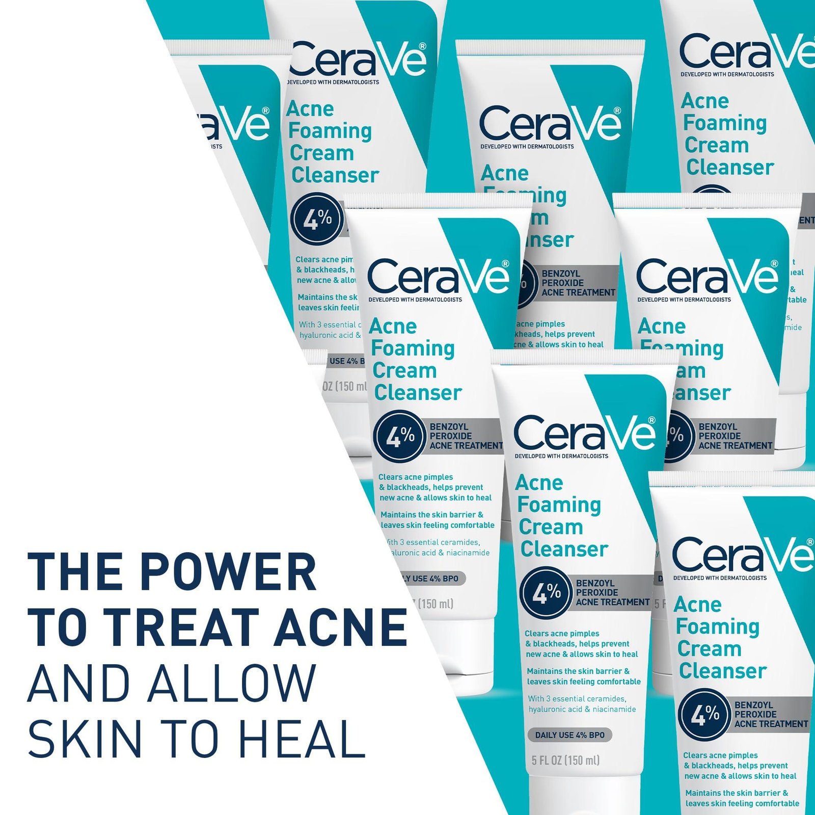 CeraVe Acne Foaming Cream Cleanser, 5 Fl Oz (Pack of 1), Packaging may Vary